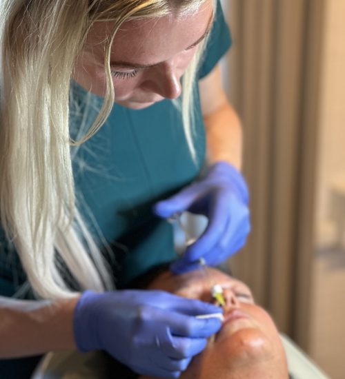 Ikke-permanent filler i ansigtet ved Fyrsterling Clinic i Odense, Fyn