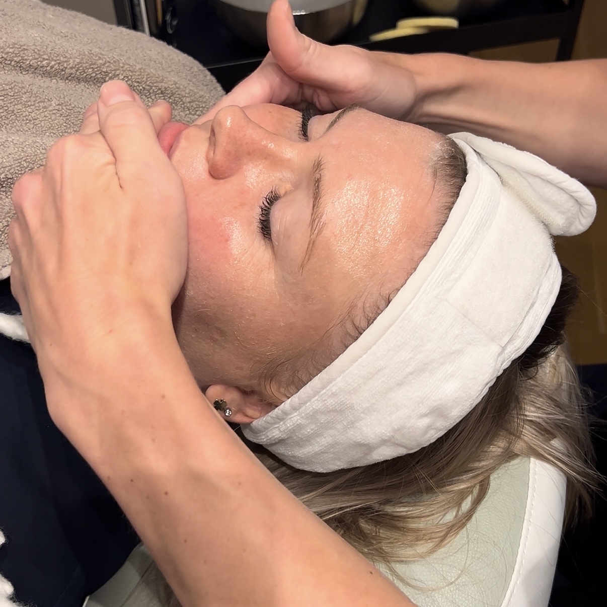 Ansigtsbehandling hos Fyrsterling Clinic