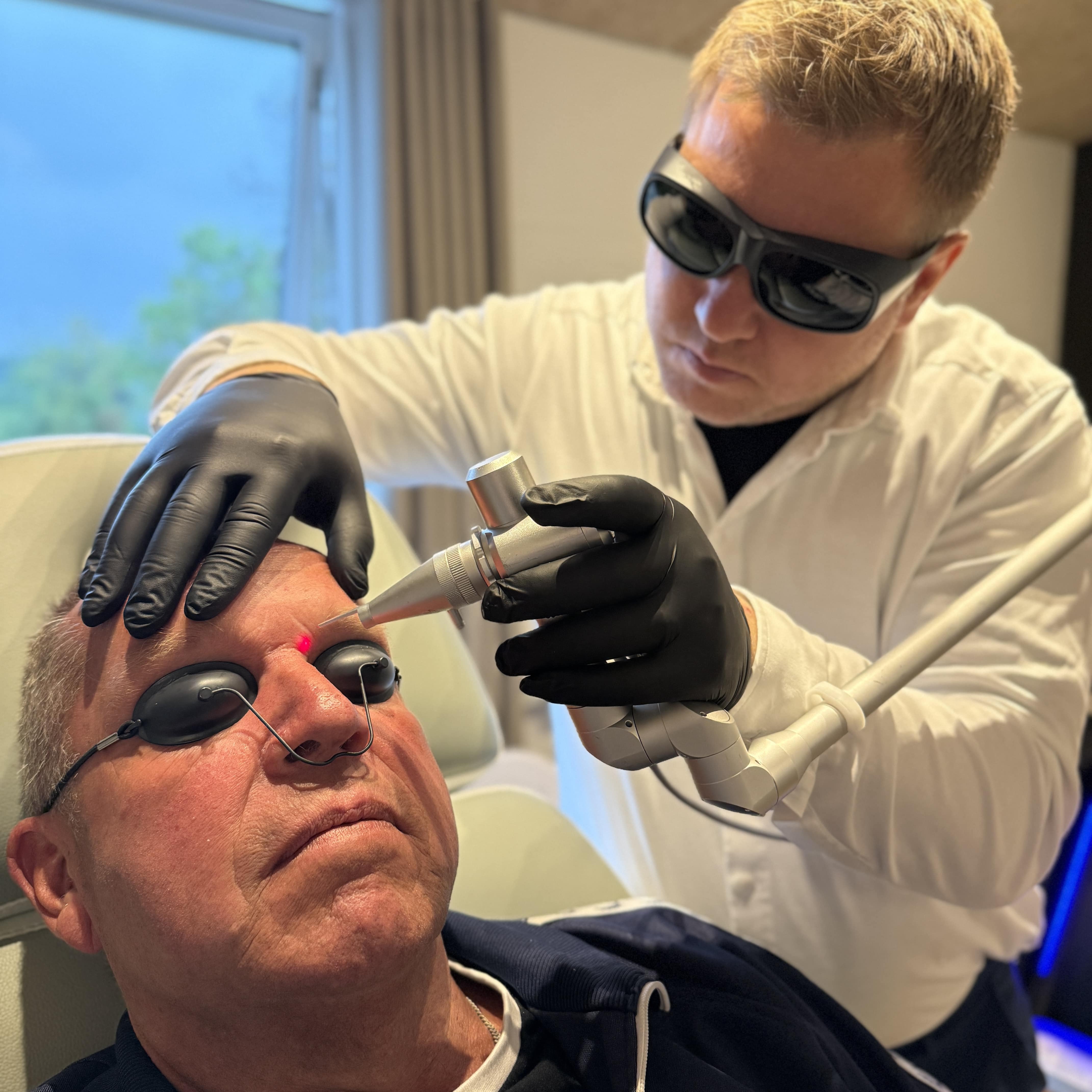 Fjernelse af gammelmandsvorte hos kosmetisk klinik i Odense på Fyn