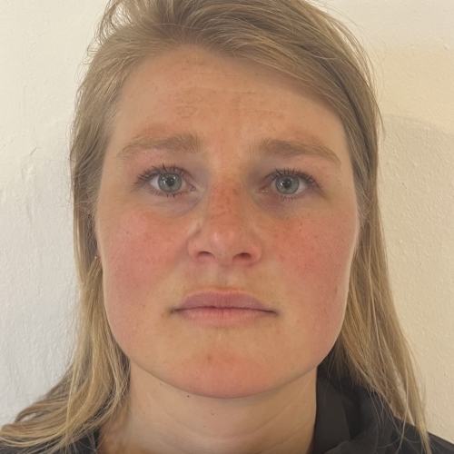 Masseter botox på kunde før behandling