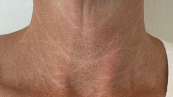 Kurforløb med 3 behandlinger Ejal40